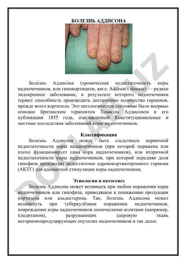 Болезнь Аддисона (хроническая недостаточность коры надпочечников)