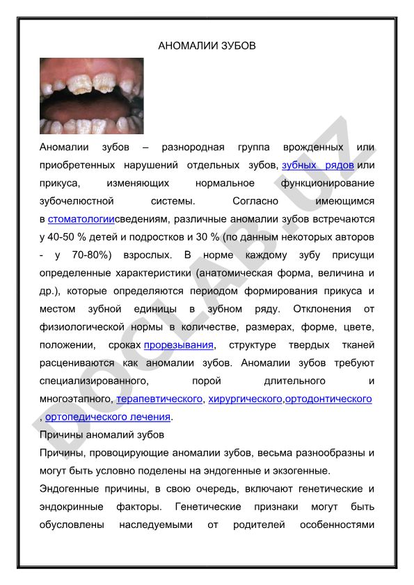 Аномалии зубов: причины, классификация и лечение