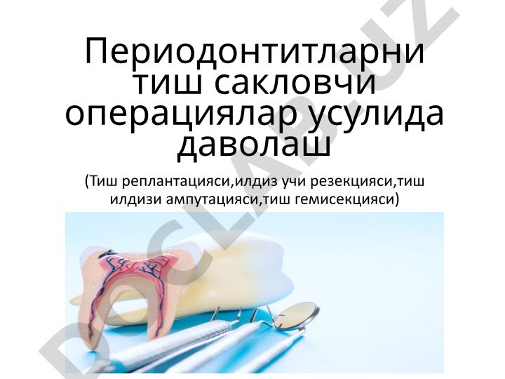 Периодонтитларни тиш сакловчи операциялар усулида даволаш