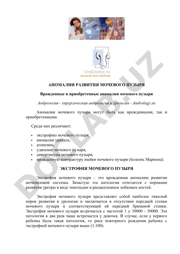 Аномалии развития мочевого пузыря