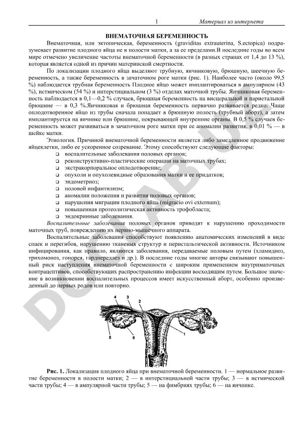 Внематочная беременность: этиология, классификация и статистика