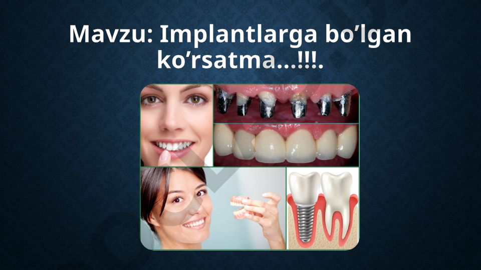 Implantlarga bo'lgan ko'rsatma va turlari