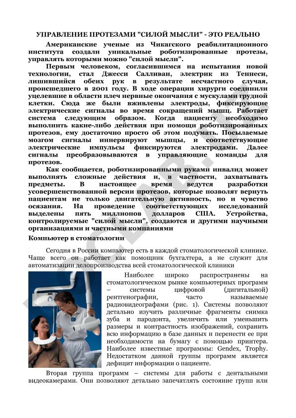 Управление протезами силой мысли