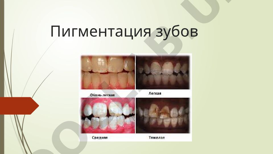 Пигментация зубов: причины, диагностика и лечение