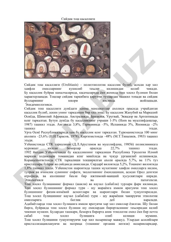 Сийдик тош касаллиги (Urolitiasis)