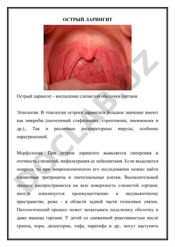 Острый ларингит: этиология, морфология и клиника