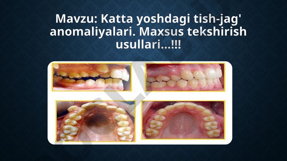 Katta yoshdagi tish-jag' anomaliyalari va maxsus tekshirish usullari