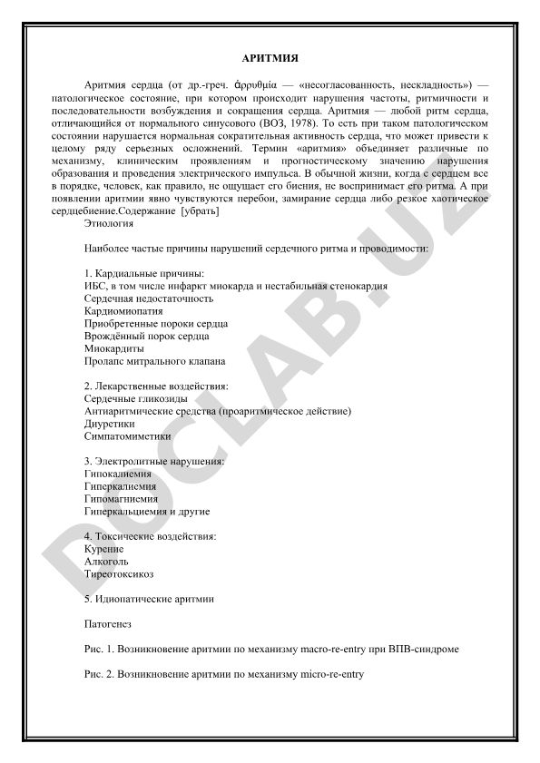 Аритмия сердца: определение, этиология и клинические проявления