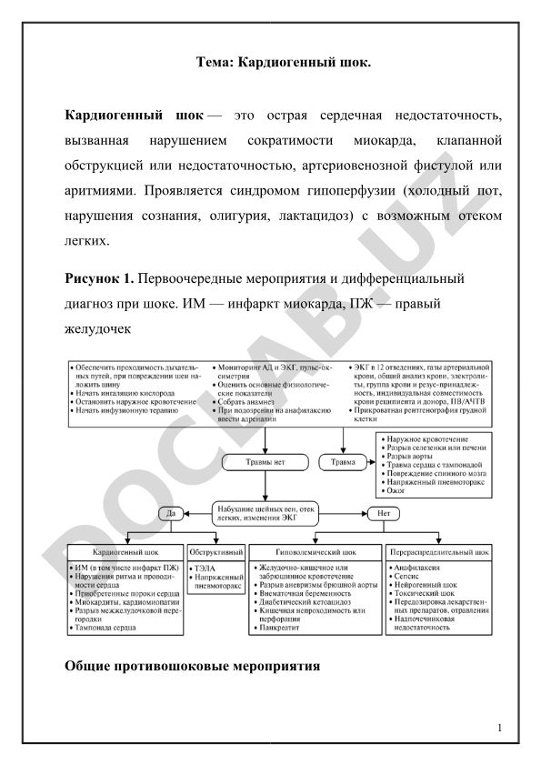 Кардиогенный шок