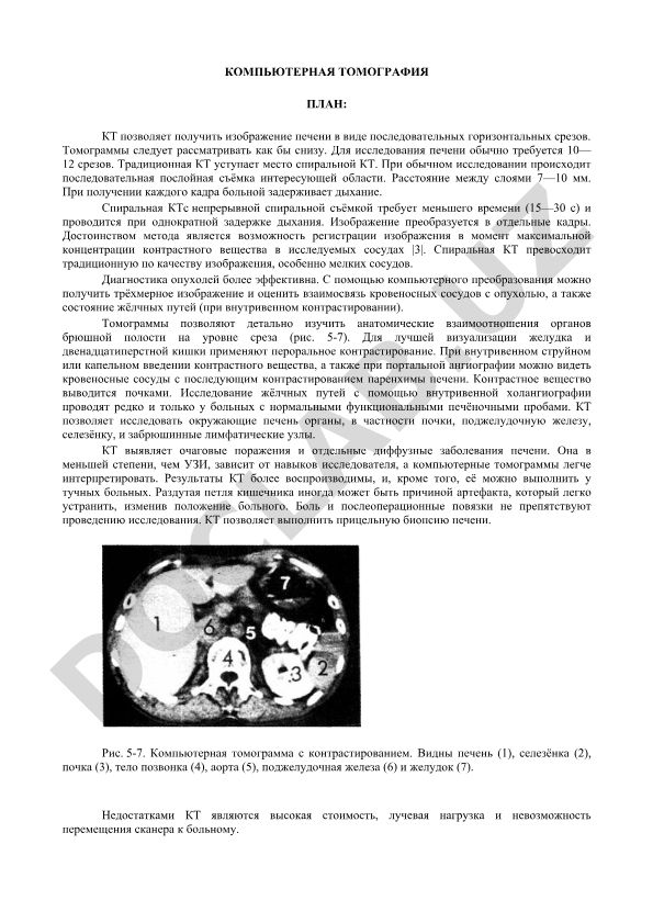Компьютерная томография печени: методы и диагностические возможности