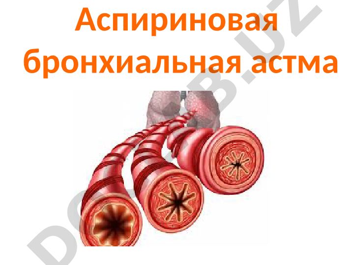 Аспириновая бронхиальная астма