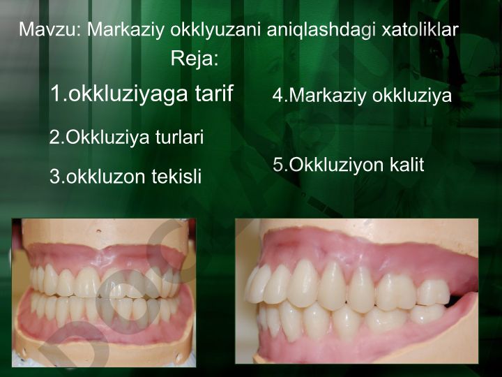 Markaziy okklyuzani aniqlashdagi xatoliklar
