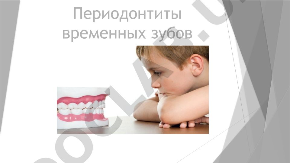 Периодонтиты временных зубов