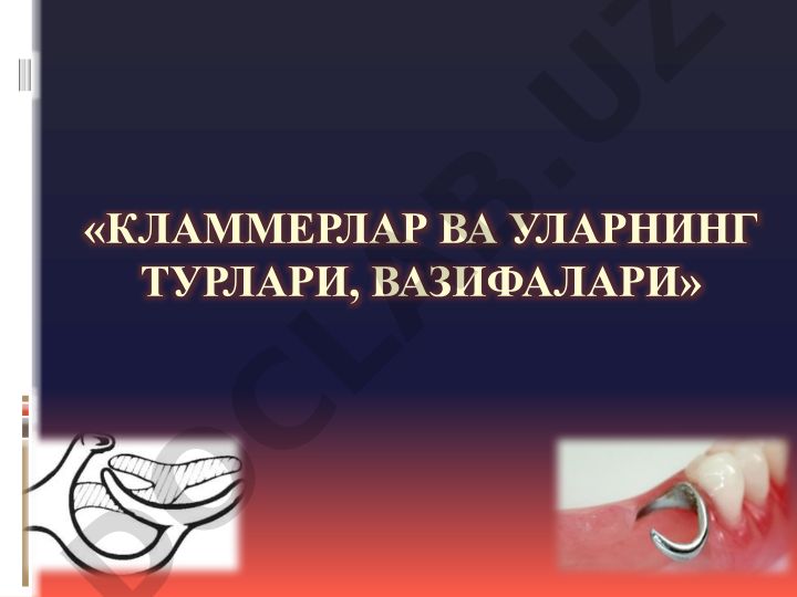 Кламмерлар ва уларнинг турлари, вазифалари