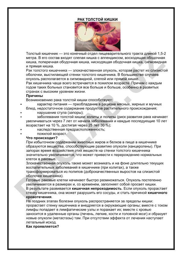 Рак толстого кишечника: причины, строение и распространенность