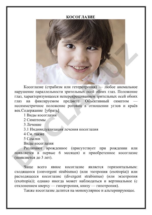 Косоглазие: виды, симптомы и лечение