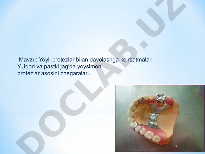Yoyli protezlar bilan davolashga ko‘rsatmalar. Yuqori va pastki jag‘da yoysimon protezlar asosini chegaralari