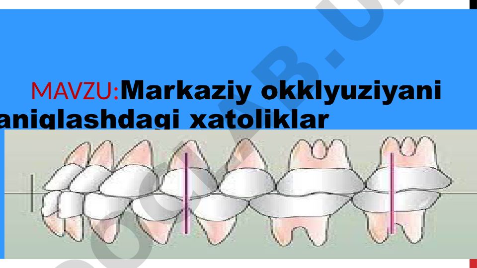 Markaziy okklyuziyani aniqlashdagi xatoliklar