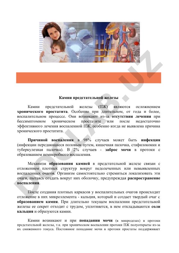 Камни предстательной железы: причины и механизм образования