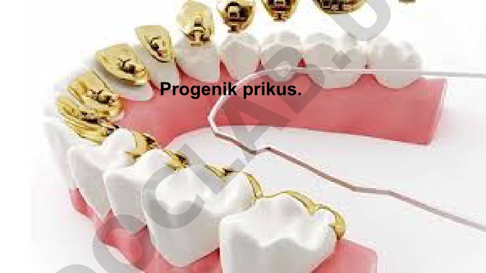 Progenik prikus: tish yoyi anomaliyalari va etiologiyasi