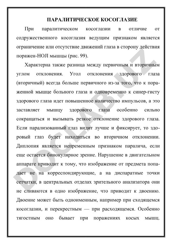 Паралитическое косоглазие: признаки и механизмы