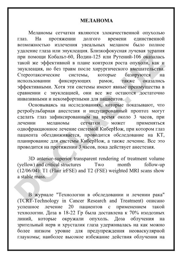 Меланома сетчатки глаза: лечение системой КиберНож