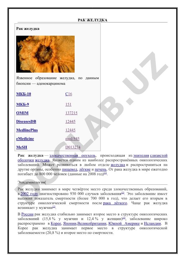 Рак желудка: эпидемиология, диагностика и лечение