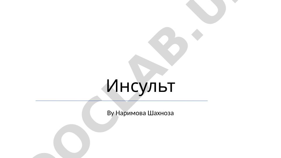 Инсульт: типы, факторы риска, диагностика, лечение и профилактика
