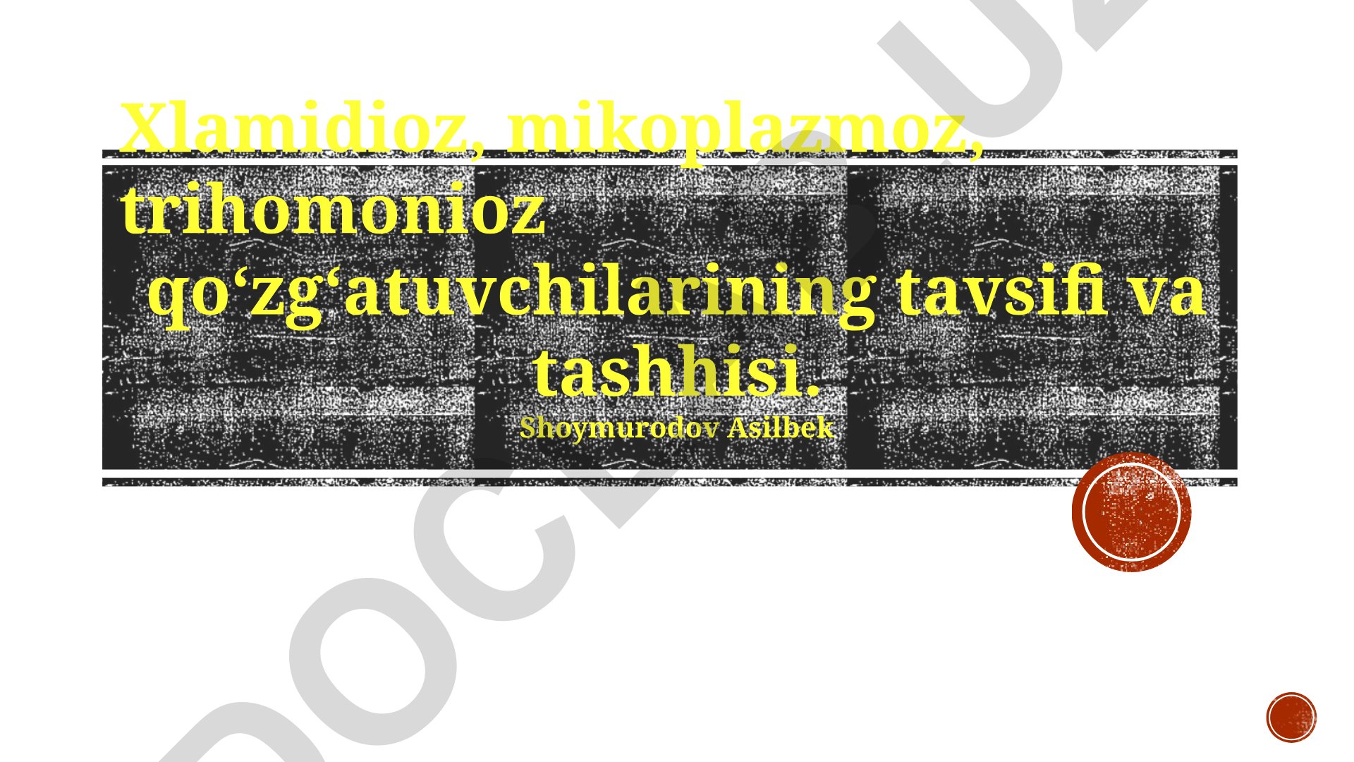 Xlamidioz, mikoplazmoz, trihomonioz qo‘zg‘atuvchilarining tavsifi va tashhisi