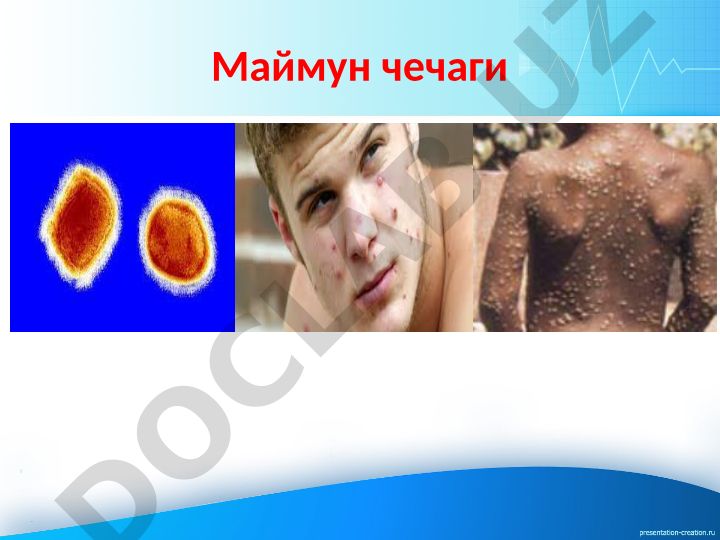 Маймун чечаги вируси ва эпидемиологияси