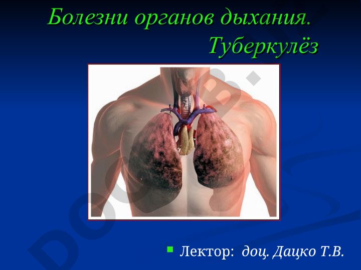 Болезни органов дыхания. Туберкулёз и острый бронхит