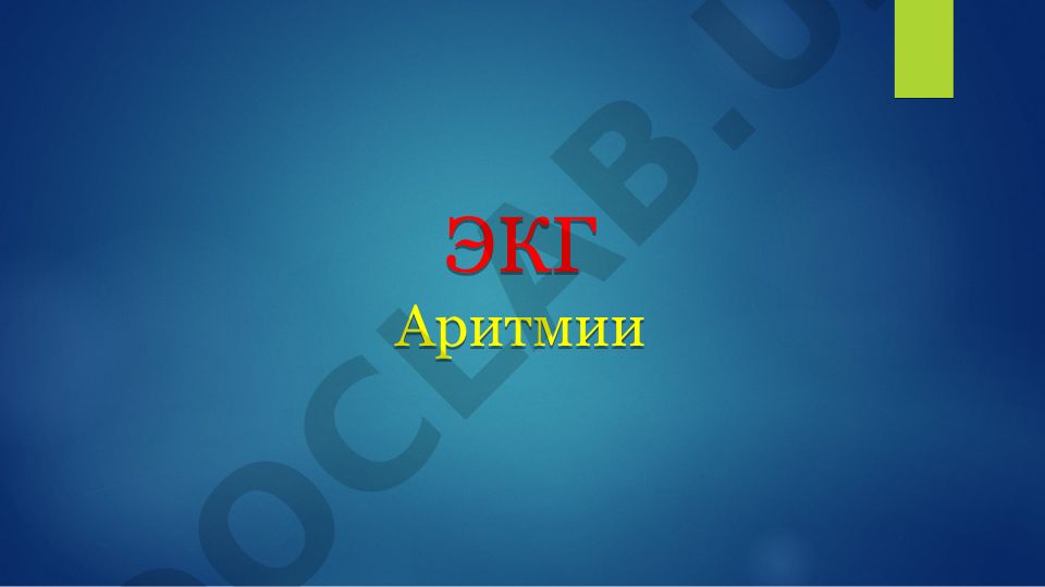 ЭКГ аритмии: мерцание предсердий