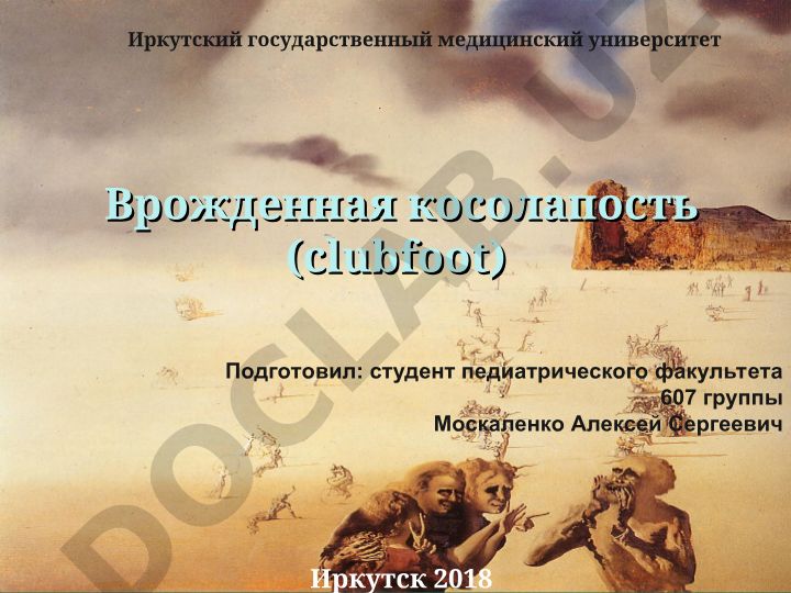 Врожденная косолапость (clubfoot)