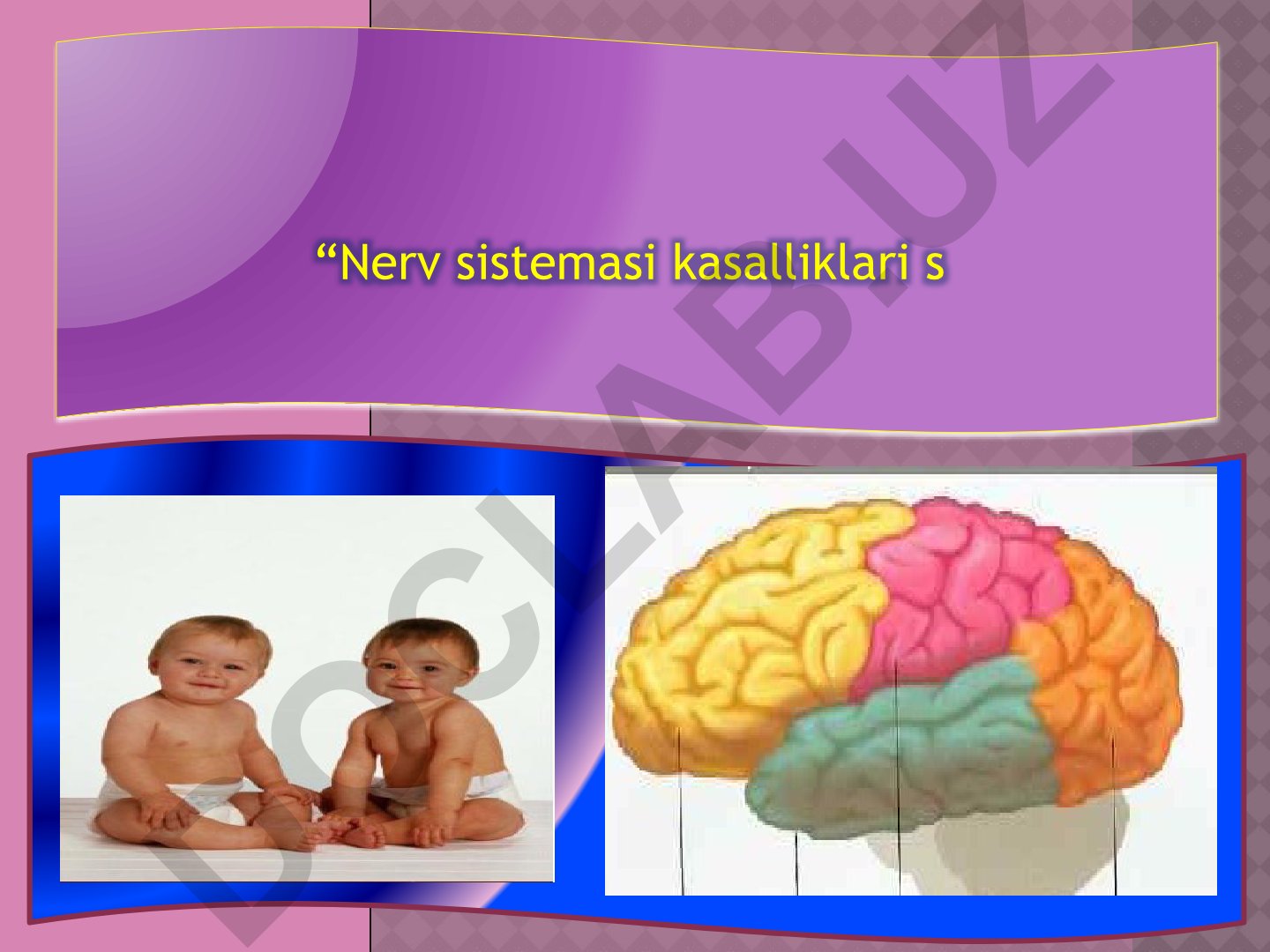 Nerv sistemasi kasalliklari