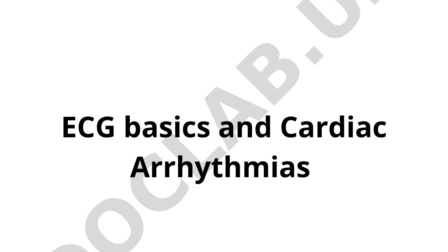 ECG basics and Cardiac Arrhythmias