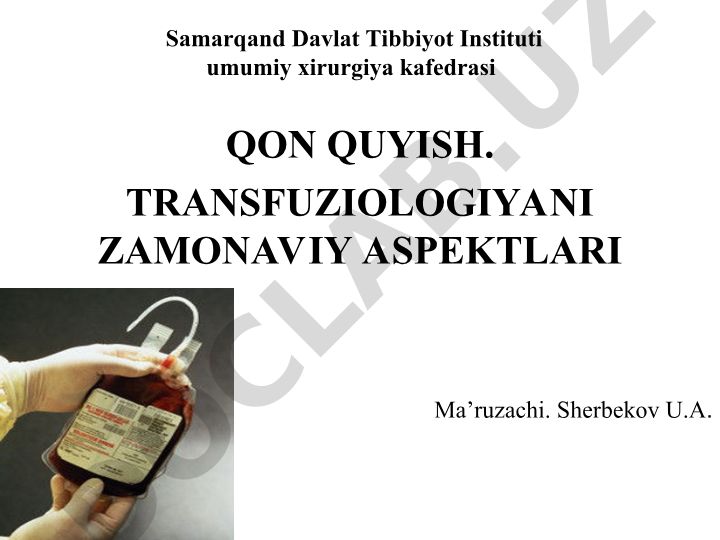 Qon quyish transfuziologiyasining zamonaviy aspektlari