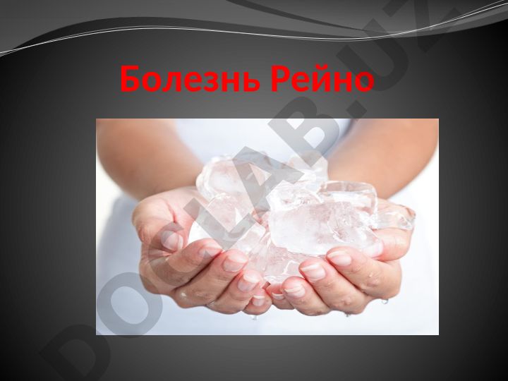 Болезнь Рейно: симптомы, механизмы и распространенность