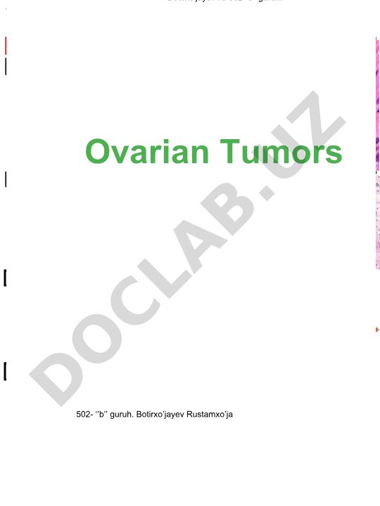Ovarian Tumors and Adnexa