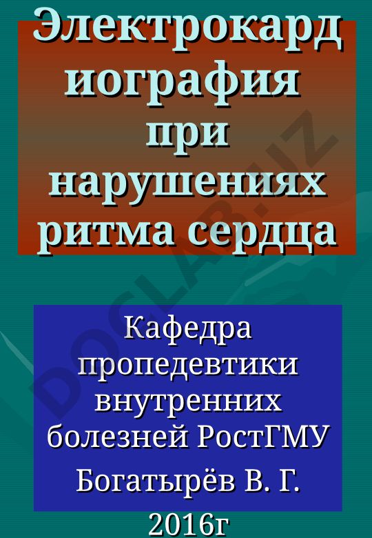 Электрокардиография при нарушениях ритма сердца
