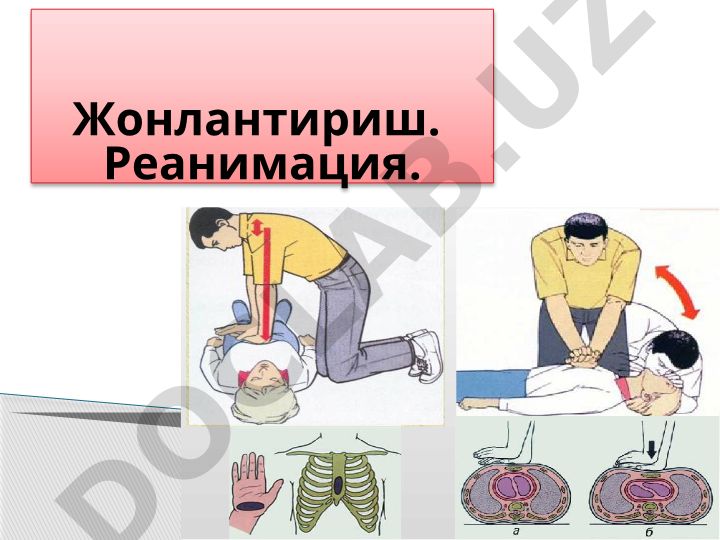 Жонлантириш ва терминал ҳолат ҳақида тушунчалар