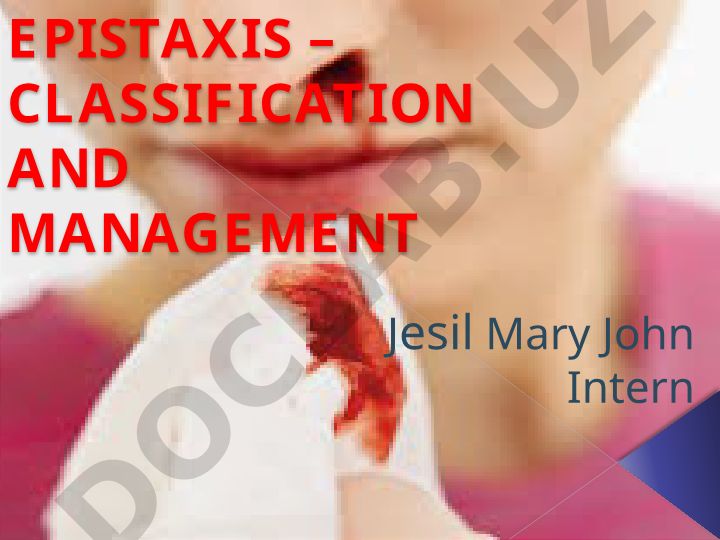 Epistaxis - tasnifi va boshqarilishi