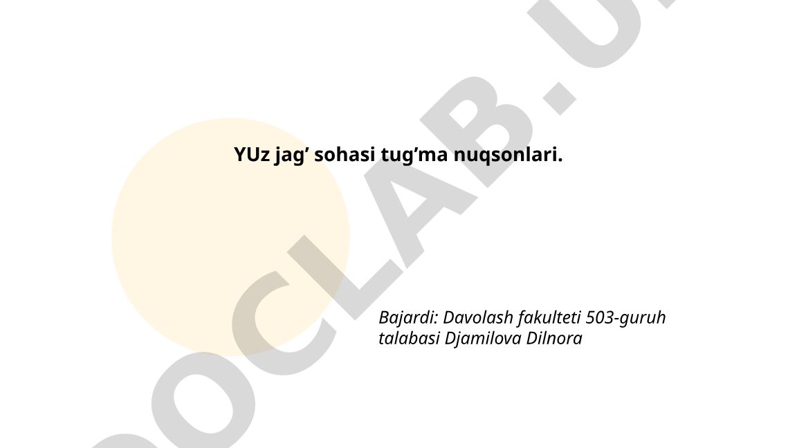 Yuz jag' sohasi tug'ma nuqsonlari