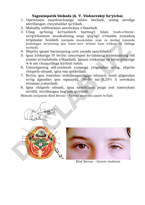 Vagosimpatik blokada (A. V. Vishnevskiy bo'yicha)