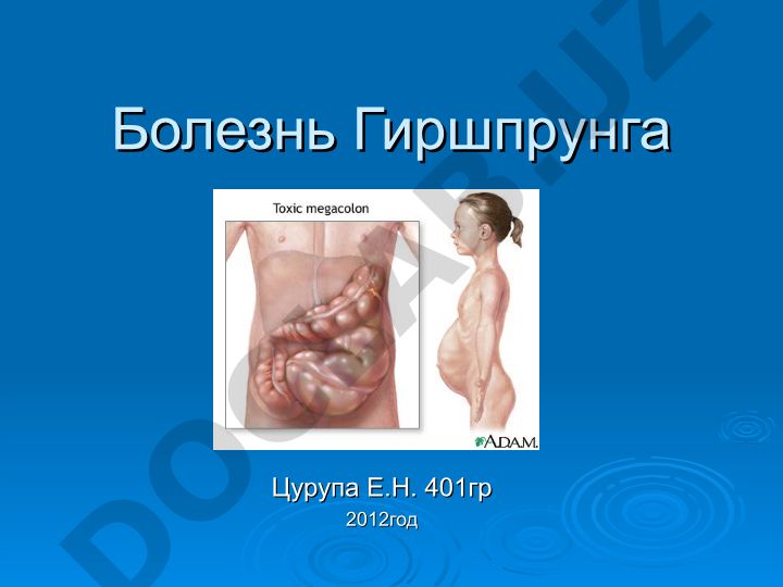 Болезнь Гиршпрунга: этиология, патогенез и клинические проявления