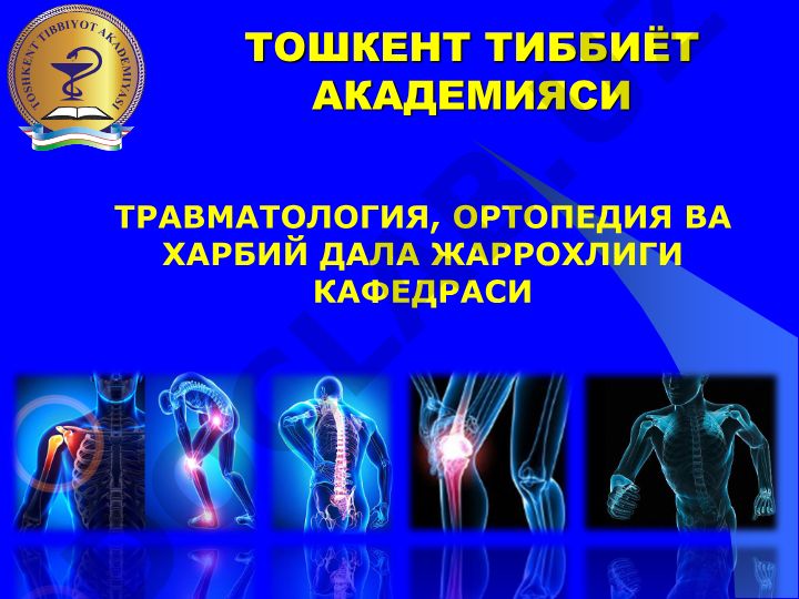Чаноқ шикастлари ва таз синишлари