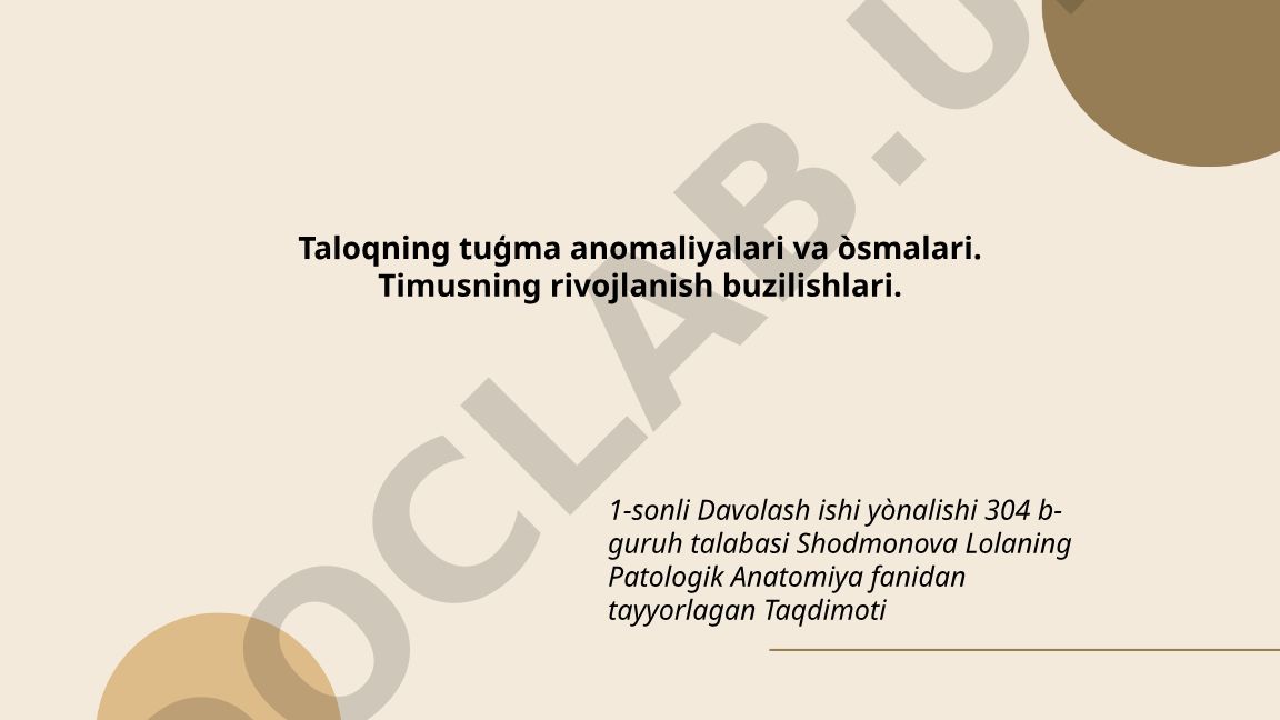 Taloqning tug'ma anomaliyalari va o'smalari. Timusning rivojlanish buzilishlari