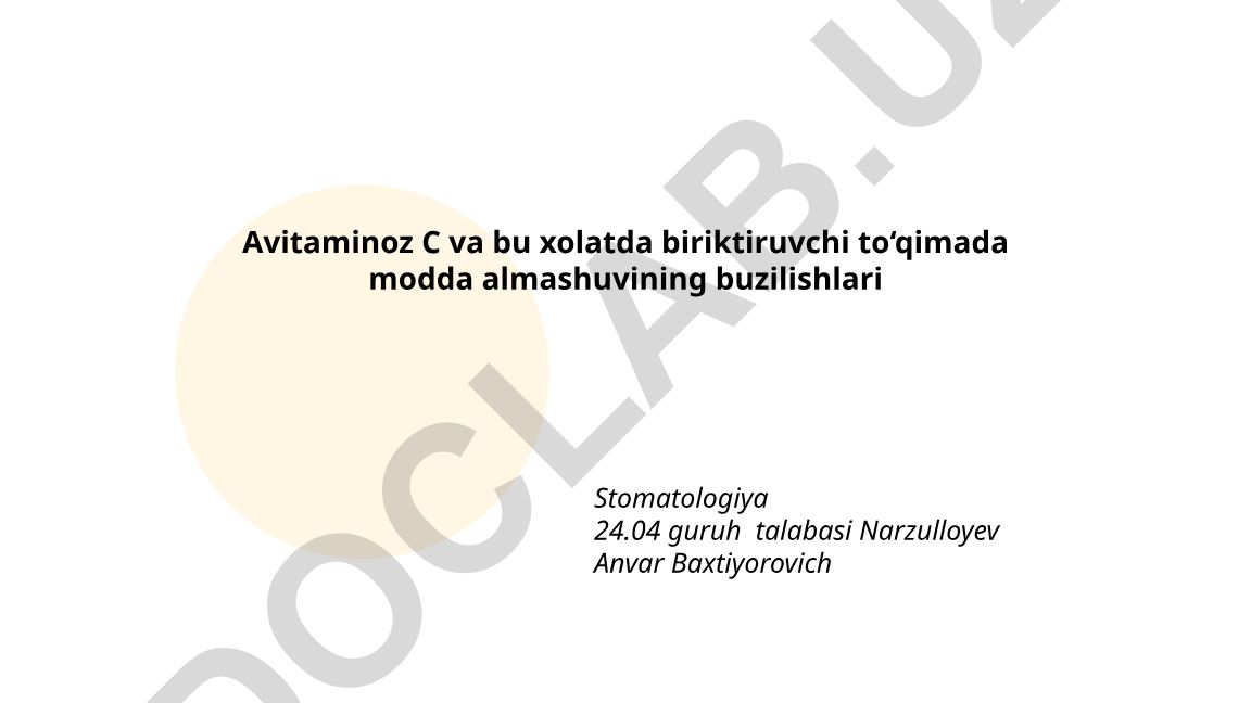Avitaminoz C va biriktiruvchi to'qimada modda almashuvining buzilishlari