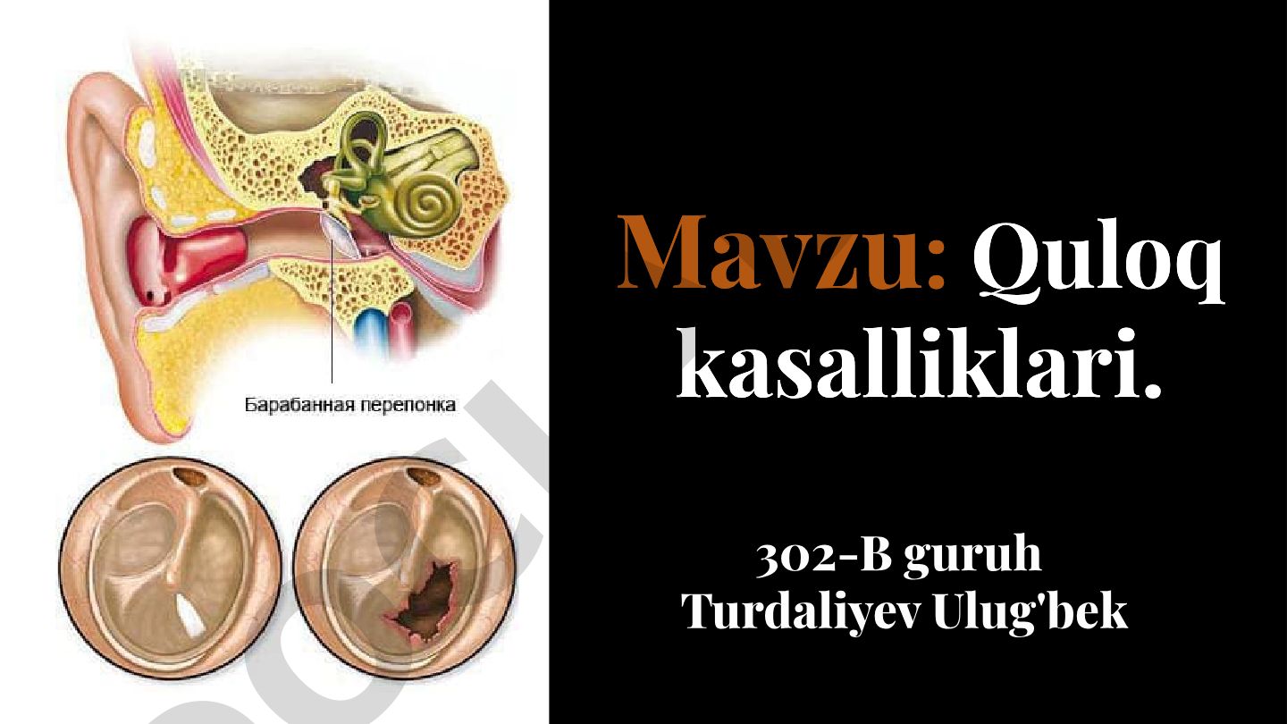 Quloq kasalliklari