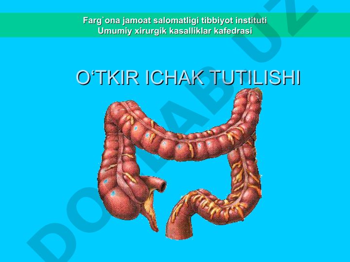 O‘tkir ichak tutilishi: klassifikatsiya, statistik ma’lumotlar va dolzarbligi