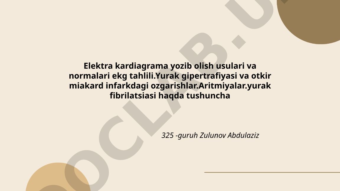 Elektrokardiogramma yozib olish usullari va EKG tahlili